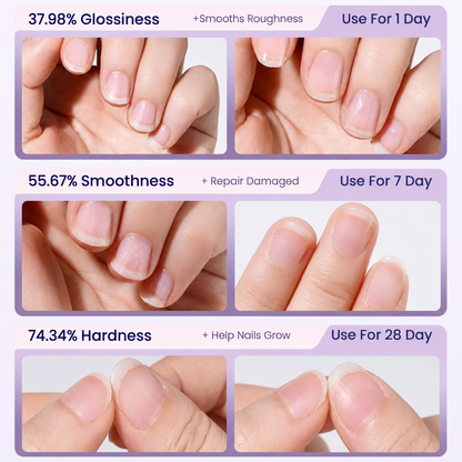 💜Martie™ 2026 New Upgraded 3-in-1 Nail Care Pen💅