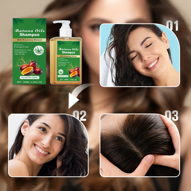 ⏰Last Day Hot Sale!!⌛🏆Buy 3 Get 2 Free ✨👧Trilumia® Batana Oil Shampoo with Rosemary Extract🌸