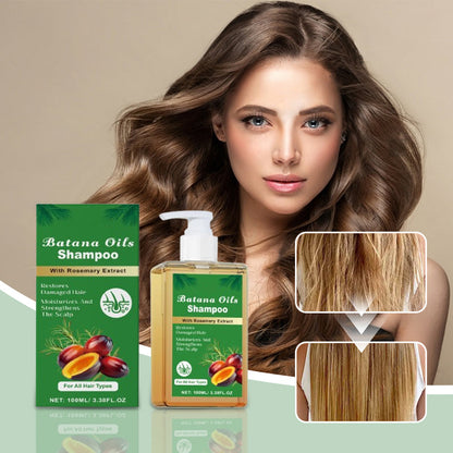 ⏰Last Day Hot Sale!!⌛🏆Buy 3 Get 2 Free ✨👧Trilumia® Batana Oil Shampoo with Rosemary Extract🌸