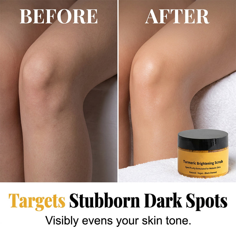 Martie™ Turmeric Exfoliating Body Scrub